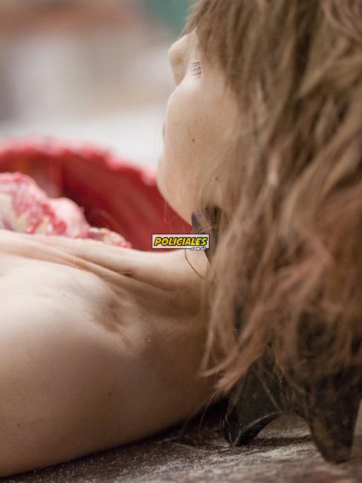 fotos-controvertidas-cadaver-abierto