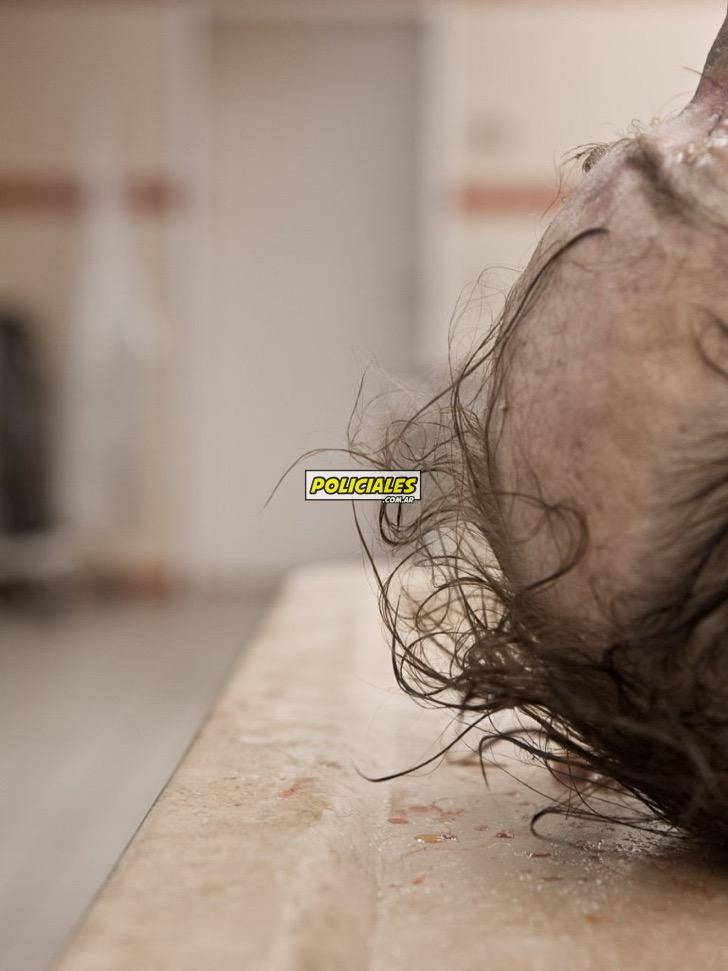 fotos-controvertidas-cadaver-morgue