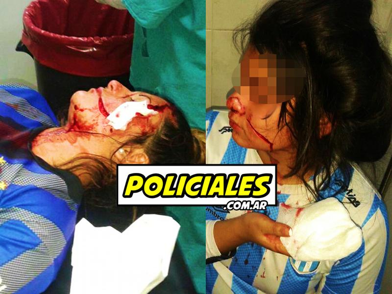 Heridas en tucumán
