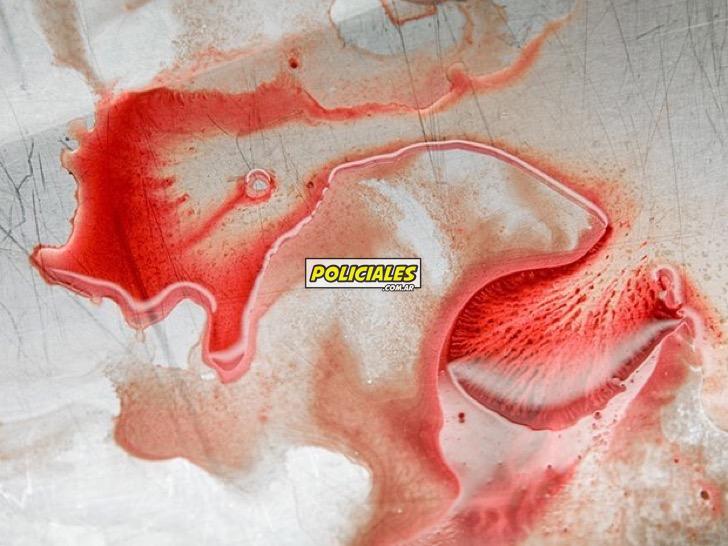 fotos-controvertidas-sangre-