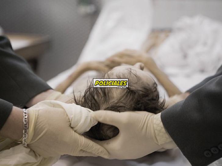 fotos-controvertidas-cadaver-patrick-budenz